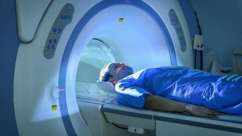 Covid prolongado: nuevos hallazgos revelan que puede provocar daños en órganos importantes