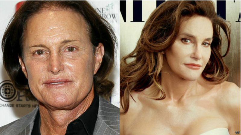 A propósito de Caitlyn Jenner: cómo se hace un cambio de sexo
