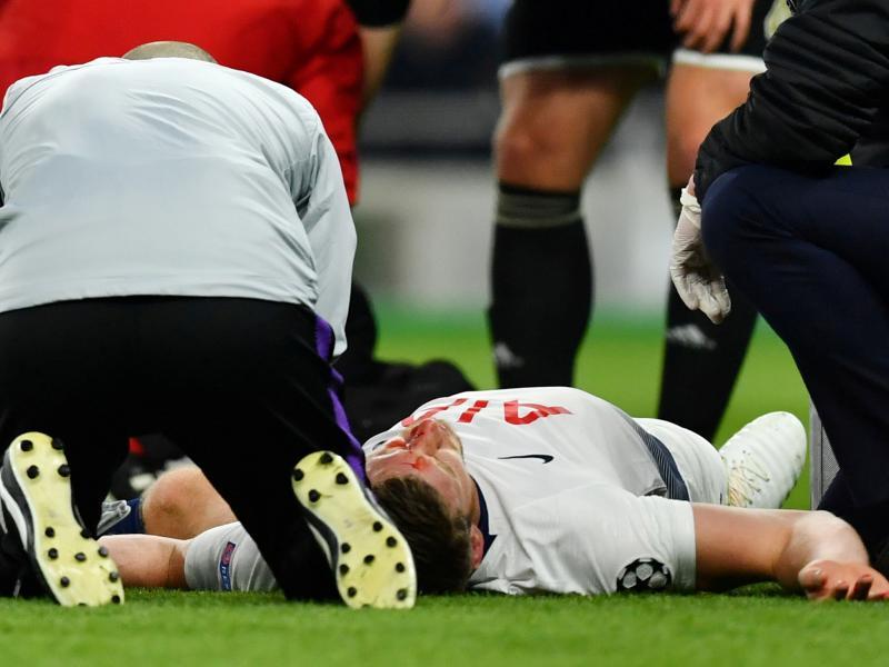 El fuerte golpe que sufrió Vertonghen frente al Ajax