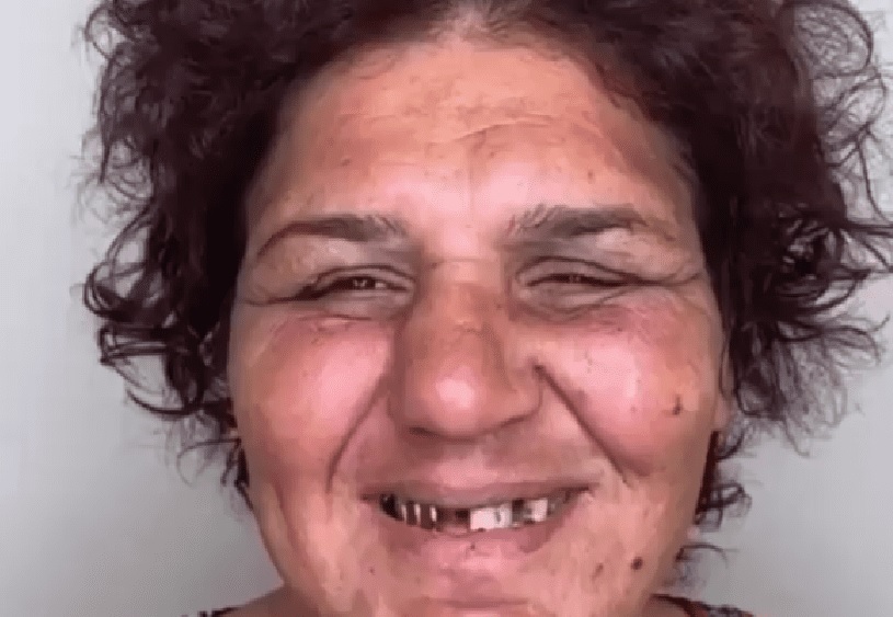 El doloroso cambio de look que ha asombrado en redes