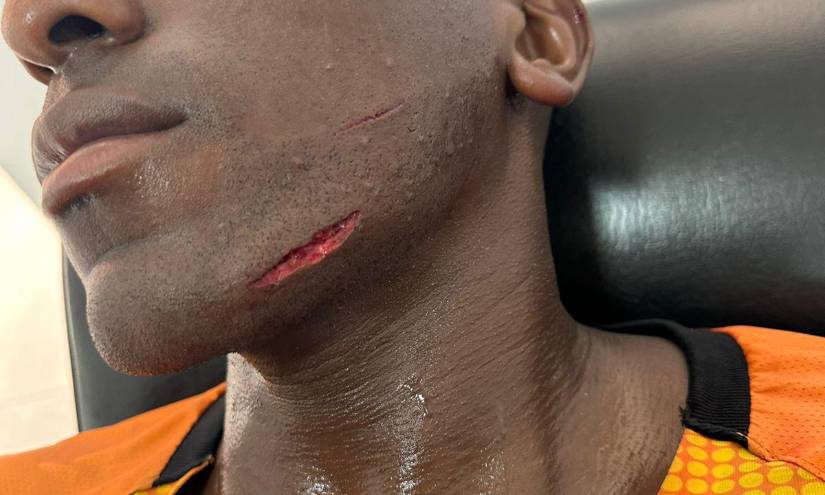 Daniel Porozo, quien fue la figura del encuentro, salió con un corte en la cara tras una fuerte entrada.