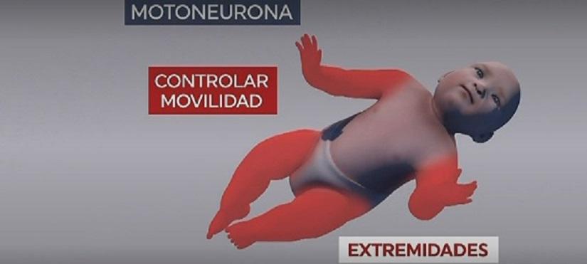 ¿Qué es la atrofia muscular espinal?