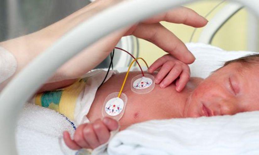 Un bebé prematuro nace antes de 37 semanas completas de gestación