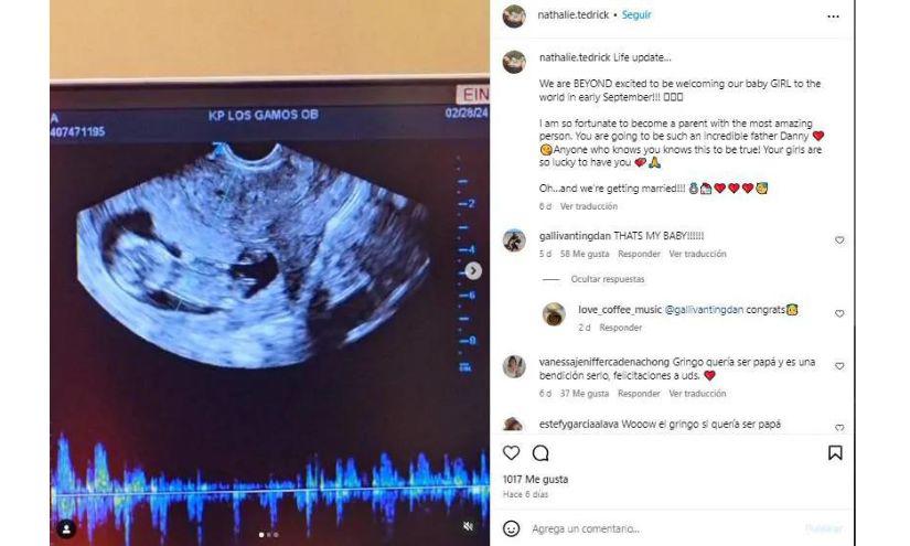 La ecografía del bebé de Glick y su novia.