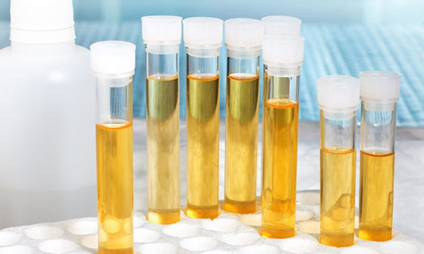 Imagen referencial. Muestras de orina.