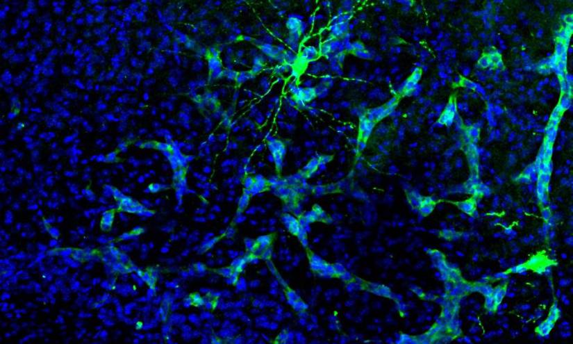 Metástasis en cerebro de ratón. Se aprecia cómo la metástasis (verde más claro) interacciona con una neurona (verde más intenso). Esta neurona está marcada específicamente para su estudio, pero la metástasis está interaccionando con muchas más