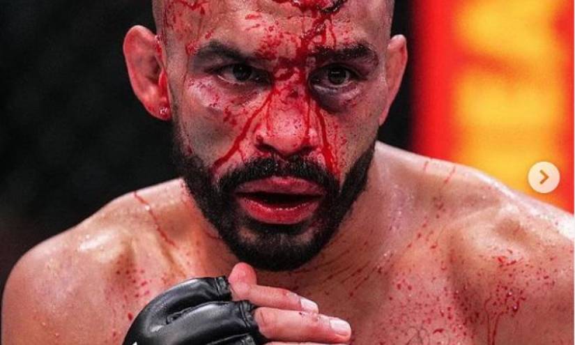 Chito Vera: Así le dejó el rostro a Rob Font tras el combate en el UFC