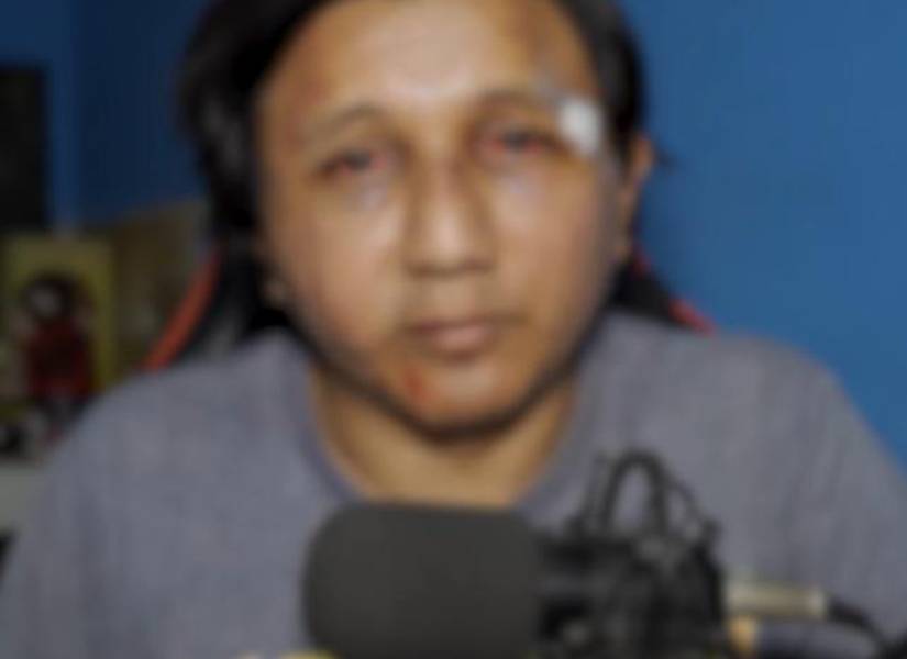 Youtuber 'Kreizivoy' fue secuestrado y brutalmente golpeado en Guayaquil