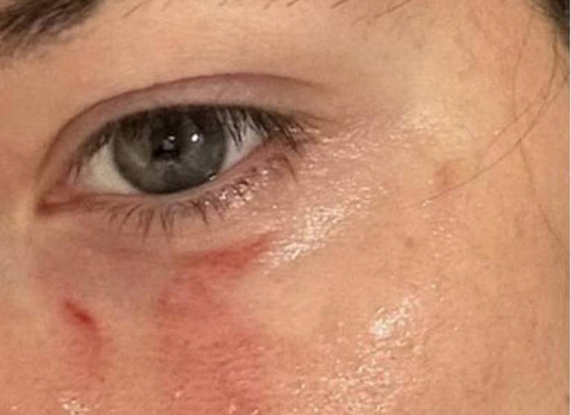 Fotos enviadas por Pamela Genini a su amiga Elisa Bartolotti.