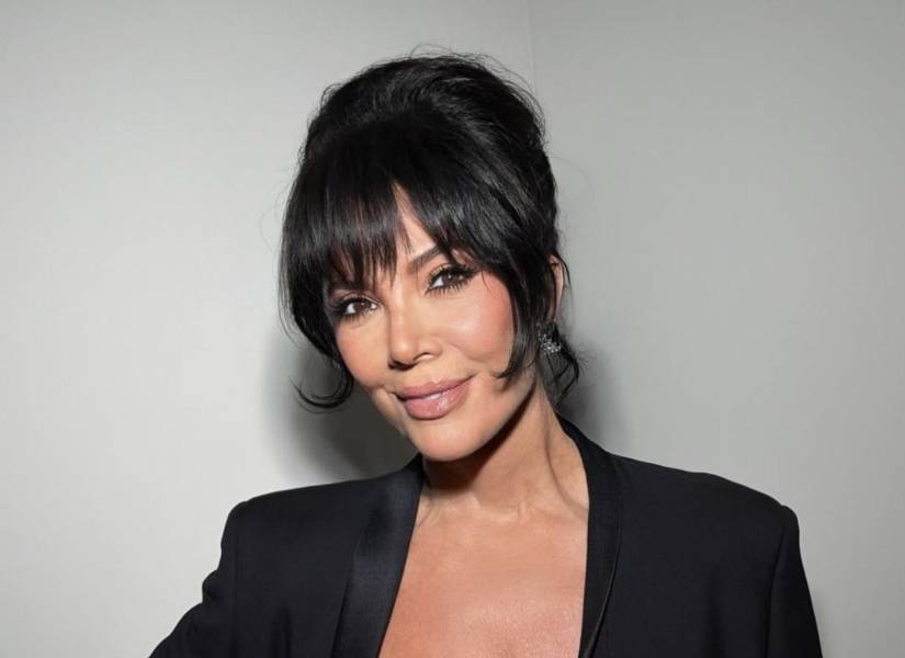 Kris Jenner se sometió a dos estiramientos faciales.