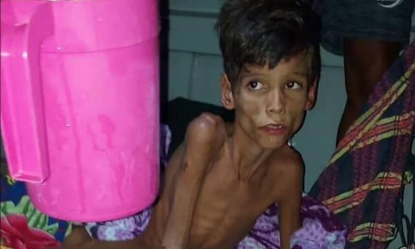 Dos niños estuvieron un mes perdidos en la selva amazónica de Brasil y sobrevivieron bebiendo agua de lluvia