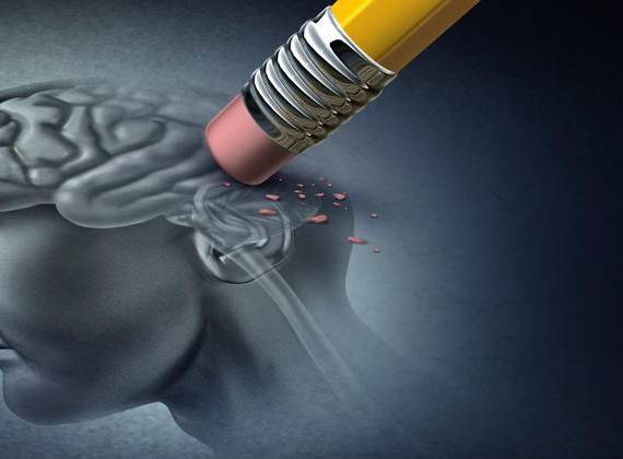 En Ecuador se han registrado unos 80.000 casos de Alzheimer