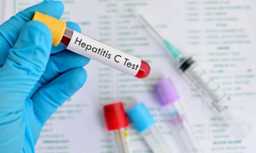 Padecer hepatitis C es un importante factor de riesgo del cáncer de hígado.