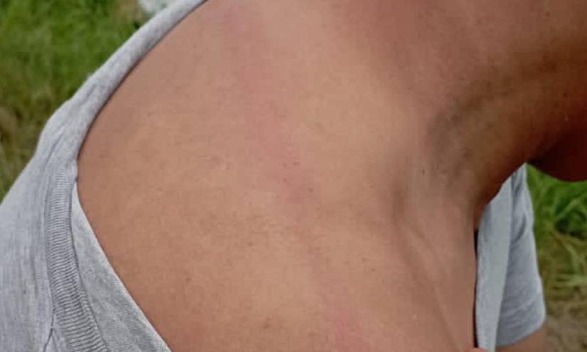 El camarógrafo de Ecuavisa fue agredido a latigazos.