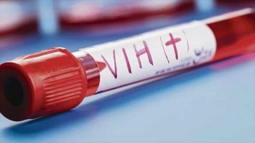 Una nueva vacuna podría contener el VIH sin el tratamiento antirretroviral