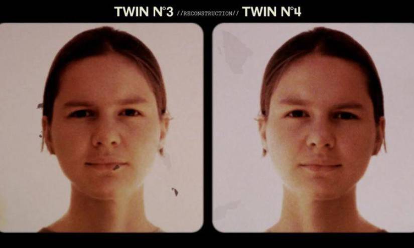 Las gemelas separadas al nacer como parte de un experimento oscuro que se reencontraron décadas después