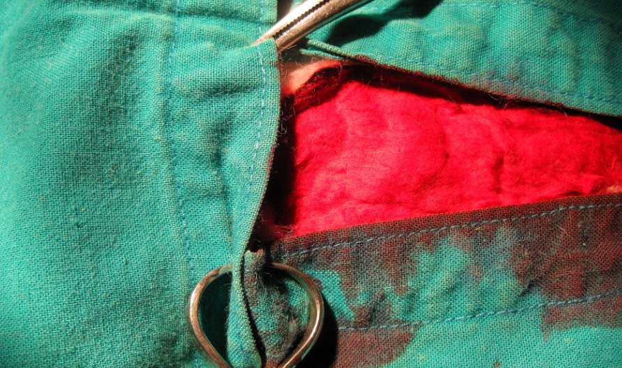 Egipto: Acusan a médico y padre de extraer genitales a niñas