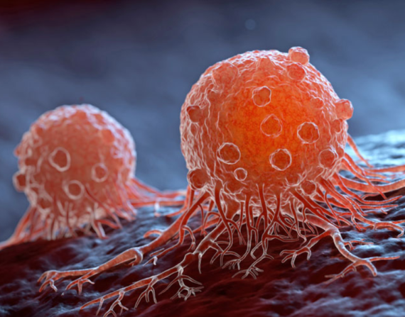 El cáncer empieza cuando las celulas afectadas comienzan a multiplicarse rápidamente.