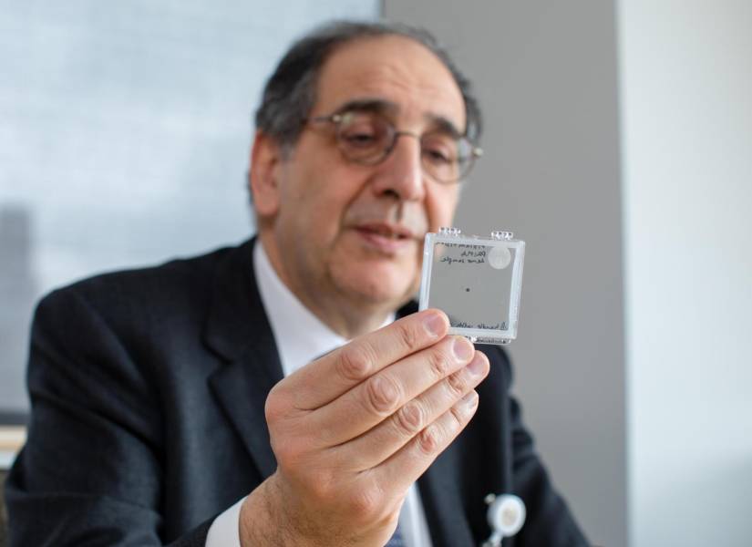 Jose-Alain Sahel, investigador de oftalmología de la Universidad estadounidense de Pittsburgh y uno de los autores del hallazgo, sostiene el implante ocular Prima. Imagen cedida por el consorcio Science Corporation que ha desarrollado esta prótesis ocular