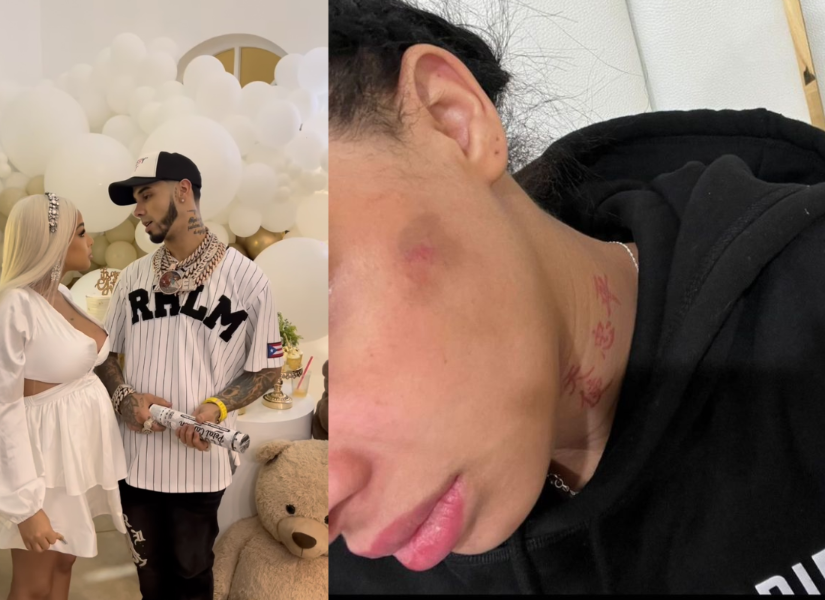 Imagen de archivo baby shower Yailin / imagen del hematoma publicada en la actualidad.