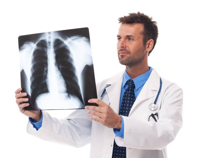 Los rayos X son una forma de detectar irregularidades en los pulmones.