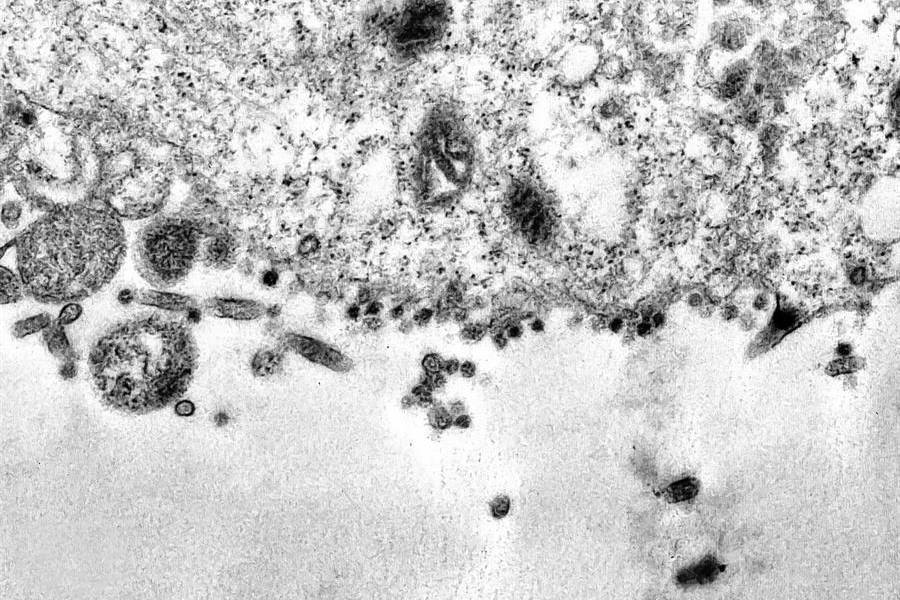 Brasil capta imágenes de momento exacto en que coronavirus infecta una célula