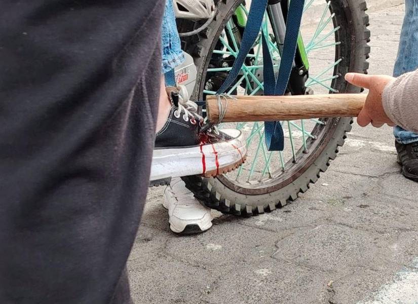 Mujer herida en su pie con una varilla.