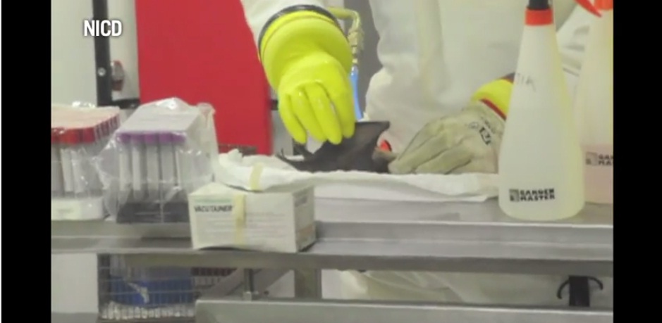 Detectan el virus del Ebola en semen tres meses después de superar los síntomas