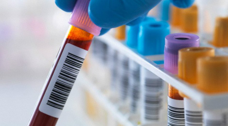 La vacuna contra el sida podría ser administrada a partir de 2016