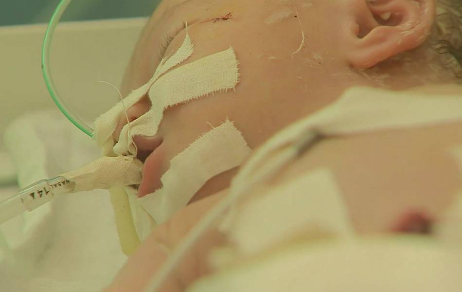 Murió bebé rescatada del vientre de su madre muerta en Gaza