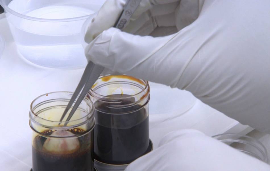 ¿Cómo funciona un banco de ojos?