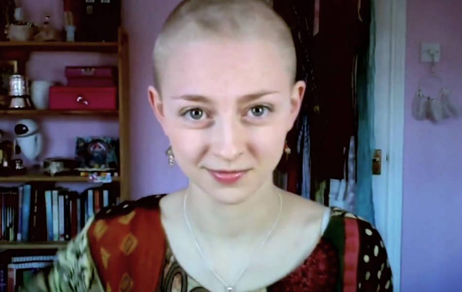 La joven que combate con &quot;selfies&quot; su rara enfermedad