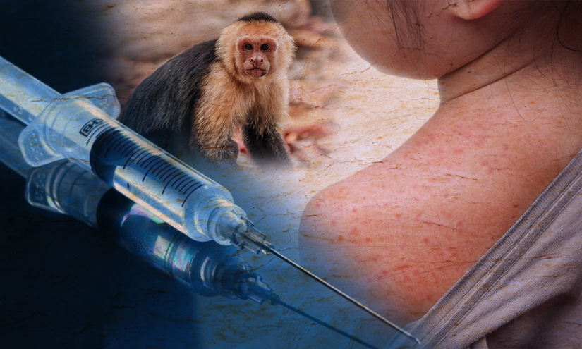 Consejos para evitar contagios de la viruela del mono en niños