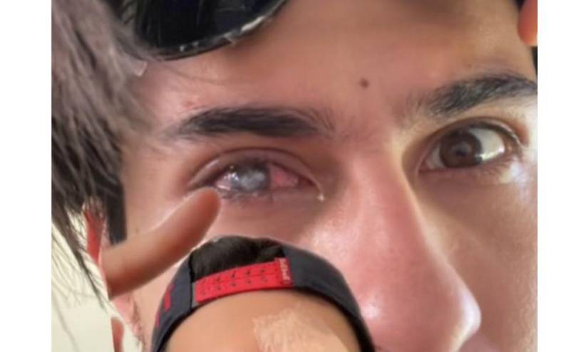 Captura de pantalla del usuario en TikTok. Una de sus fotografías mostradas con respecto a su complejo proceso médico.