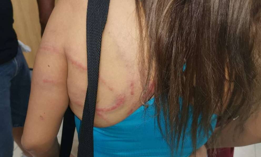 Mujer denuncia a su conviviente por haberla flagelado