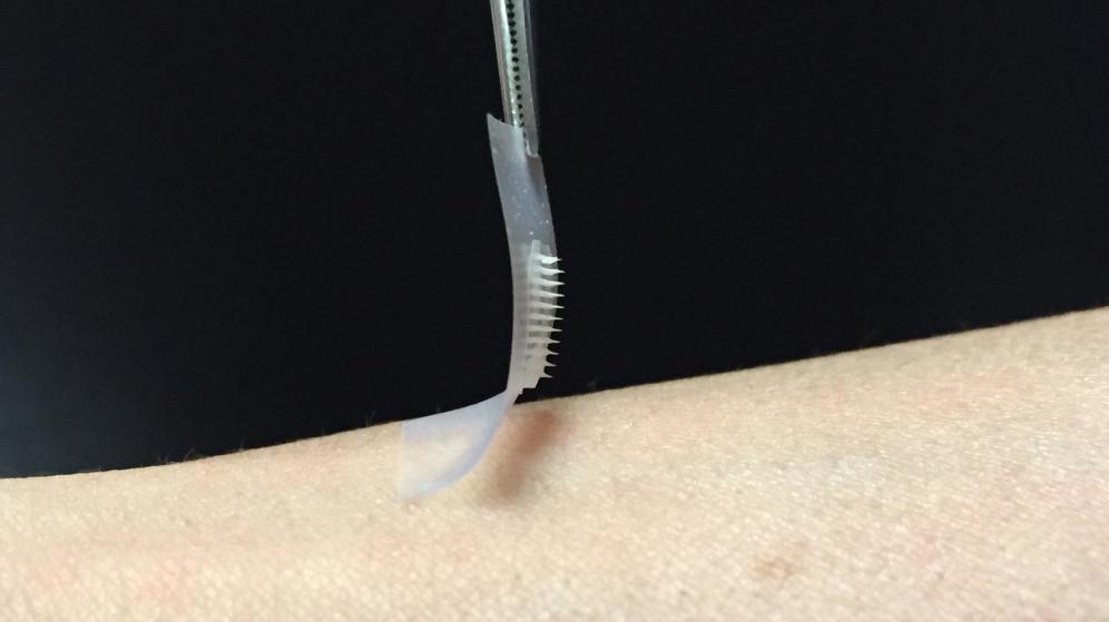 Diseñan parche de insulina para diabéticos que podría sustituir a inyecciones