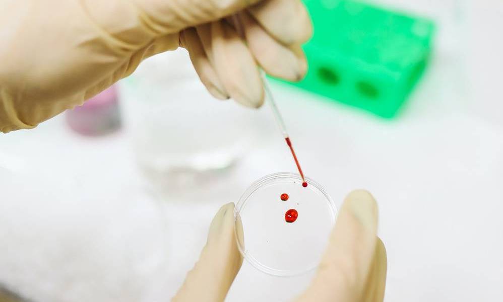 Municipio de Quito dispone de pocas pruebas de COVID-19